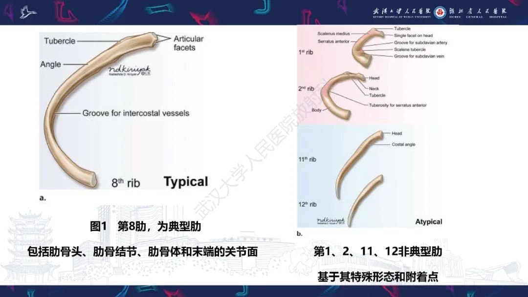 影像PPT - 【PPT】肋骨病变影像诊断-4
