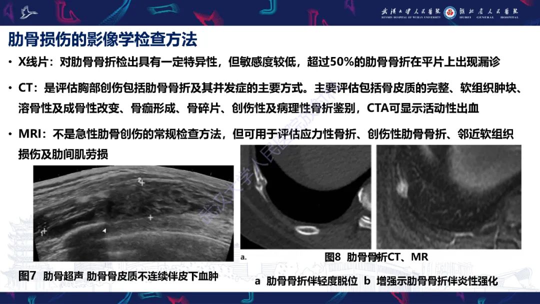 影像PPT - 【PPT】肋骨病变影像诊断-8