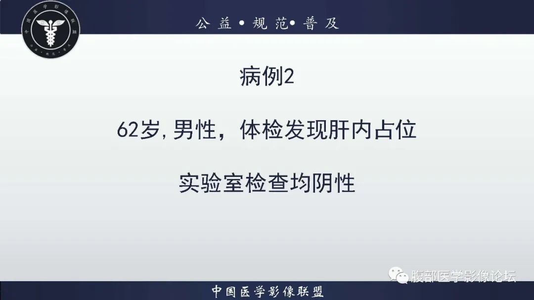 影像PPT - 【病例】肝脏淋巴瘤2例CT及MR影像-2