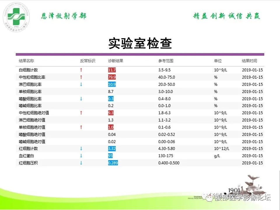 影像PPT - 【病例】肝脏淋巴瘤2例CT及MR影像-10