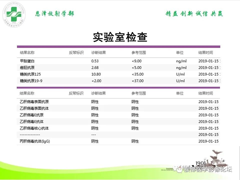 影像PPT - 【病例】肝脏淋巴瘤2例CT及MR影像-12