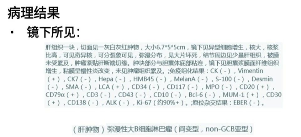 影像PPT - 【病例】肝脏淋巴瘤2例CT及MR影像-20