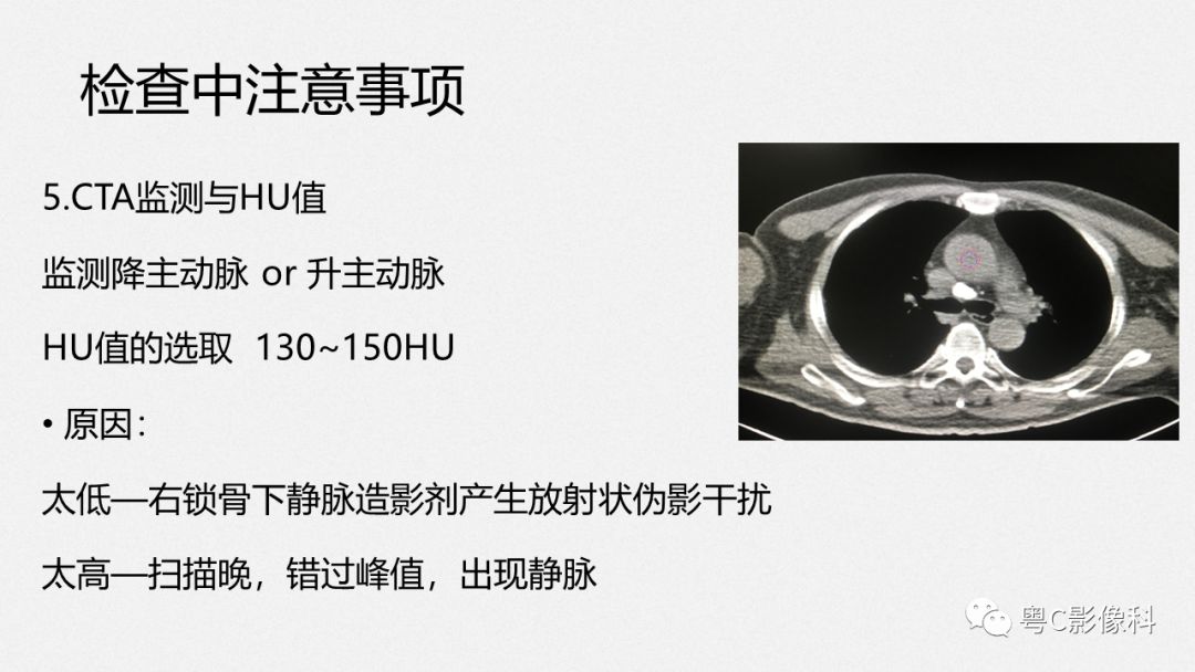 影像PPT - 【PPT】颈动脉CTA检查——How to do well?-14