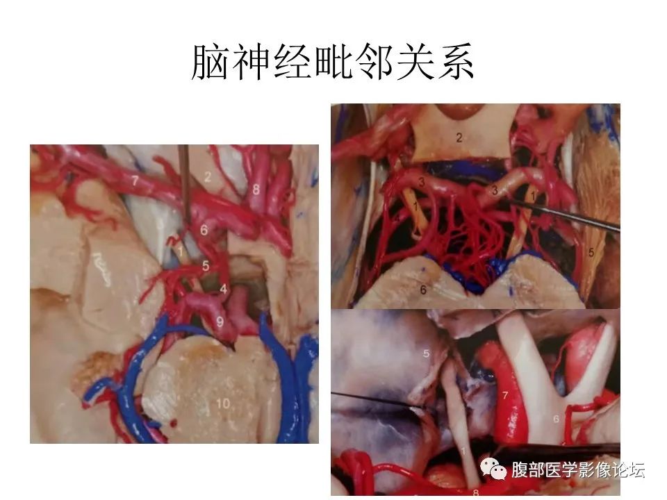 影像PPT - 【PPT】十二颅神孔道出-16