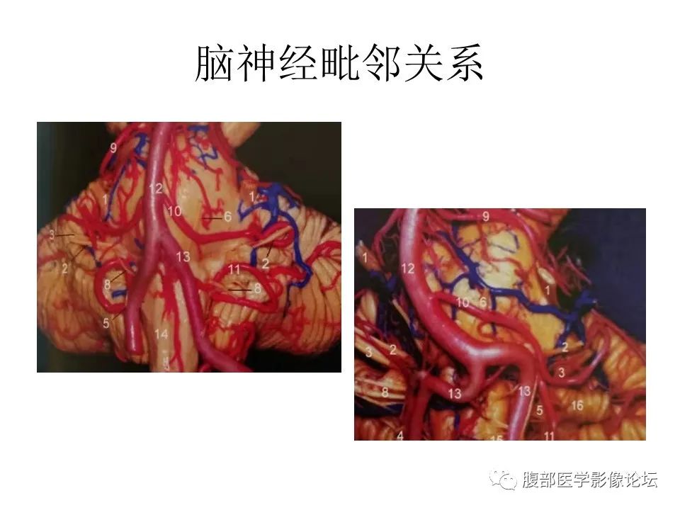 影像PPT - 【PPT】十二颅神孔道出-17