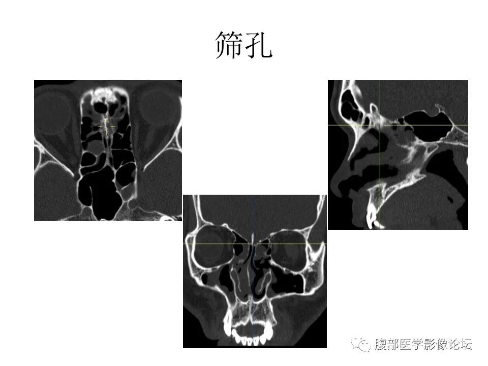 影像PPT - 【PPT】十二颅神孔道出-19