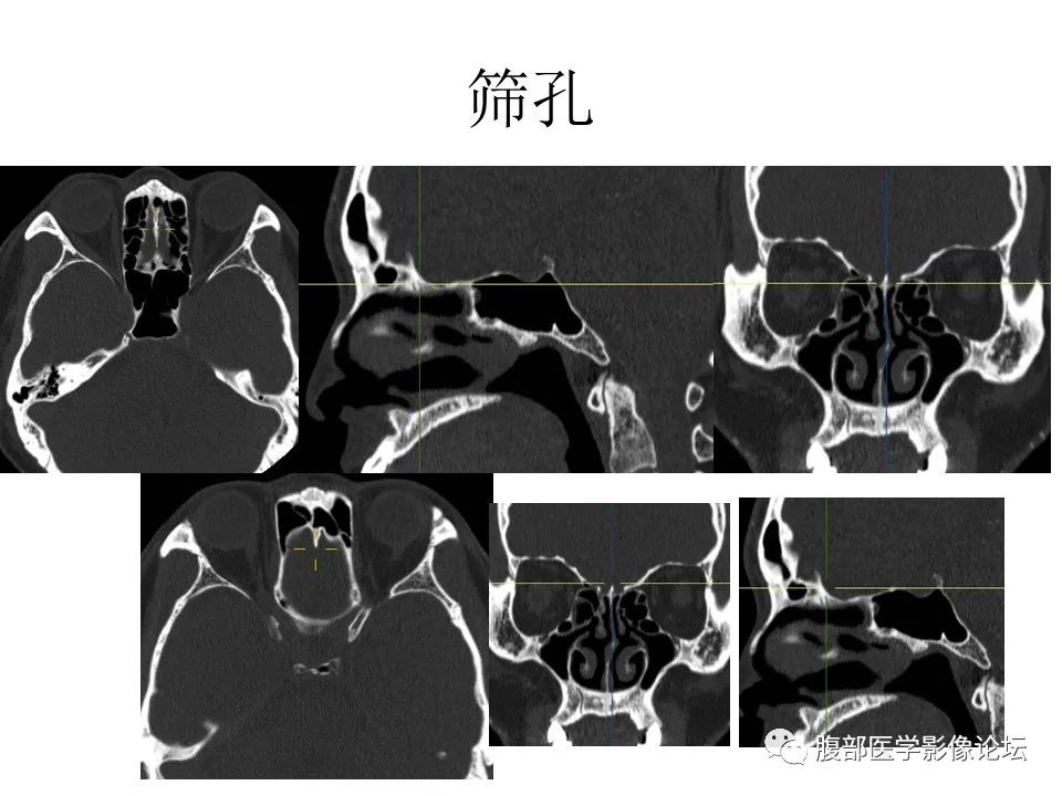 影像PPT - 【PPT】十二颅神孔道出-20