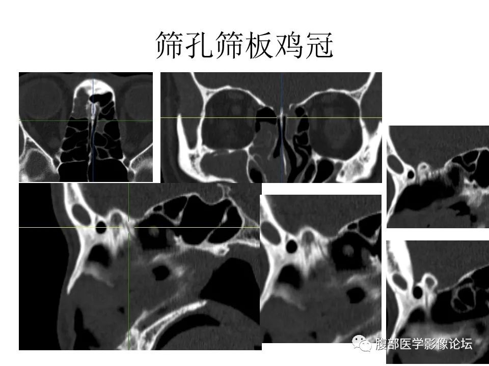 影像PPT - 【PPT】十二颅神孔道出-21