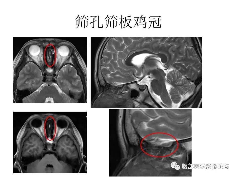 影像PPT - 【PPT】十二颅神孔道出-22
