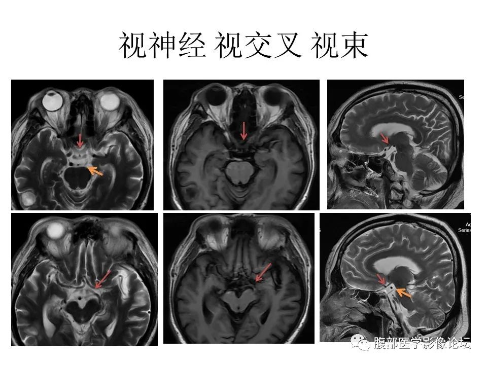 影像PPT - 【PPT】十二颅神孔道出-26