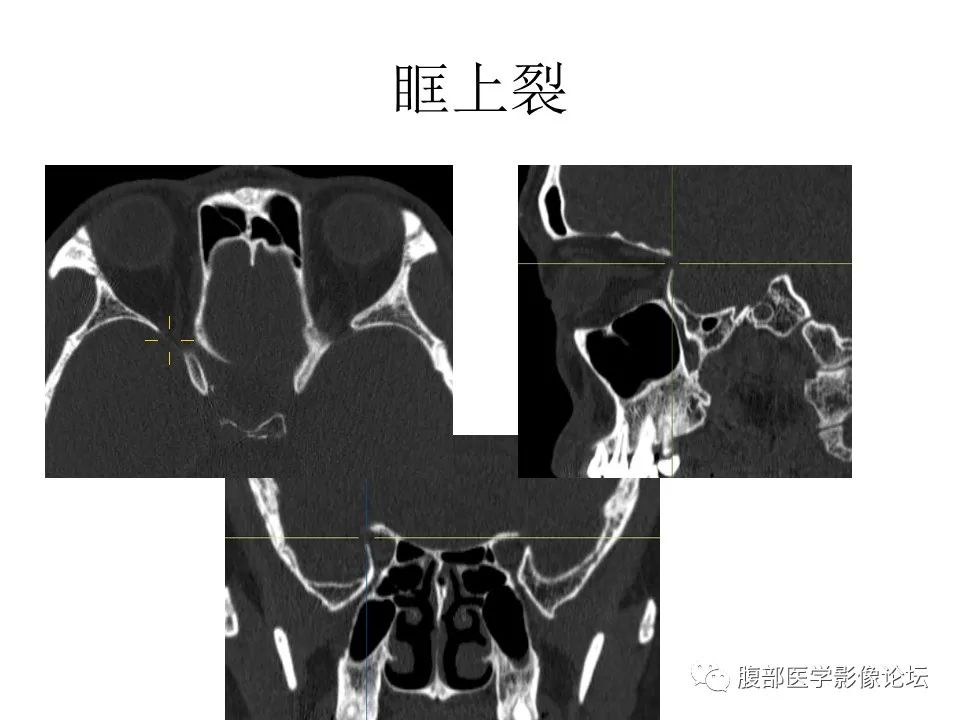 影像PPT - 【PPT】十二颅神孔道出-29