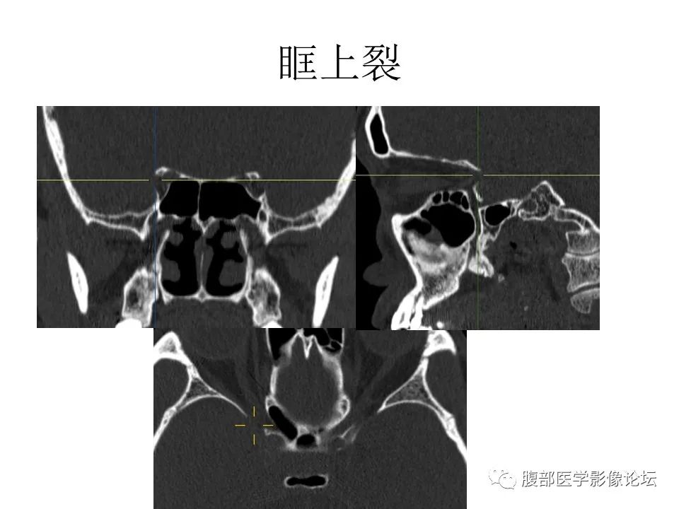 影像PPT - 【PPT】十二颅神孔道出-30