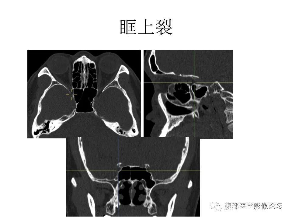 影像PPT - 【PPT】十二颅神孔道出-31