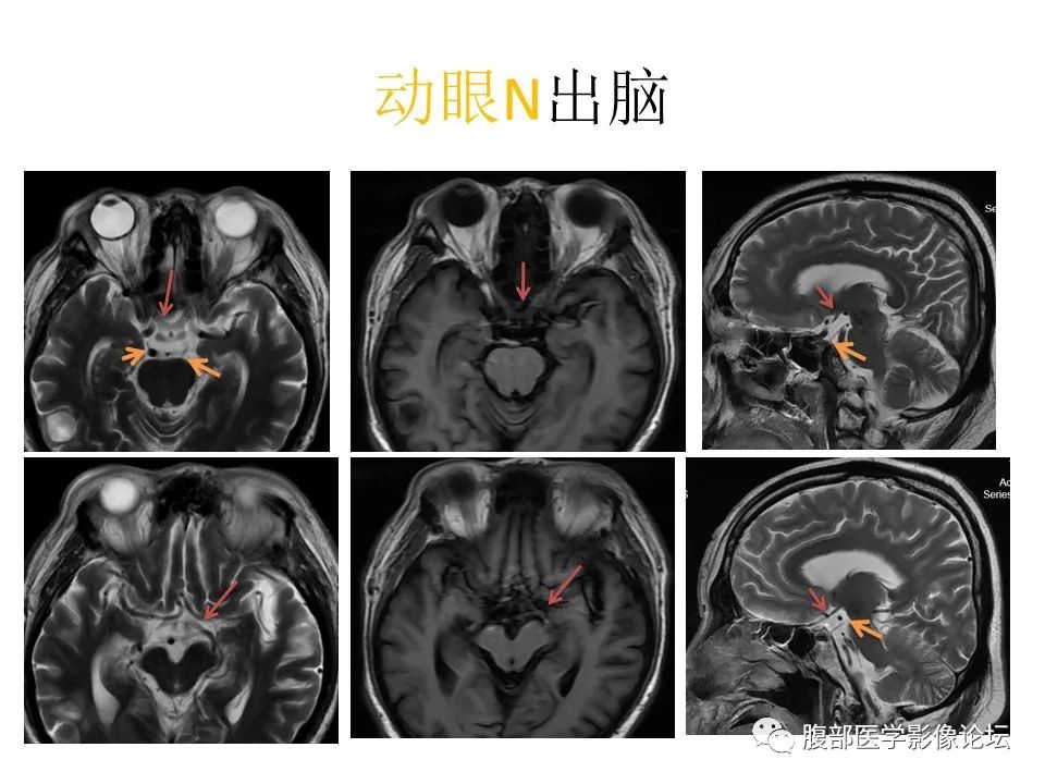 影像PPT - 【PPT】十二颅神孔道出-32
