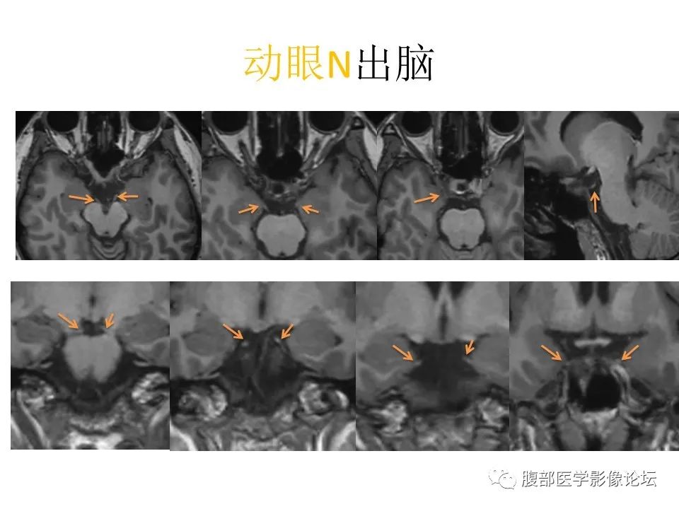 影像PPT - 【PPT】十二颅神孔道出-33