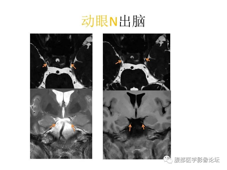 影像PPT - 【PPT】十二颅神孔道出-35