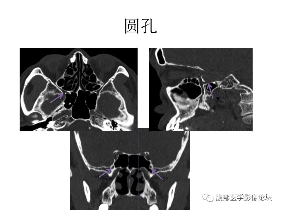 影像PPT - 【PPT】十二颅神孔道出-36