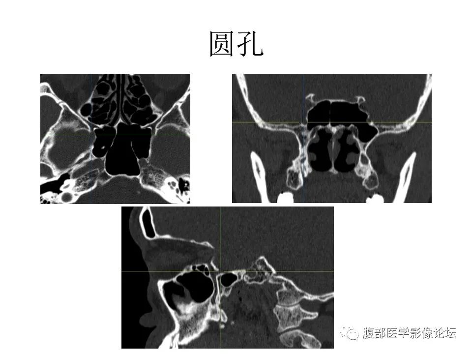 影像PPT - 【PPT】十二颅神孔道出-37