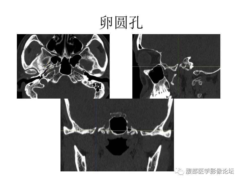 影像PPT - 【PPT】十二颅神孔道出-38