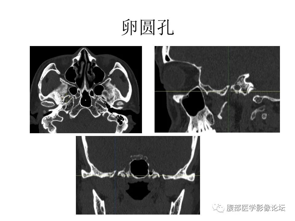 影像PPT - 【PPT】十二颅神孔道出-39