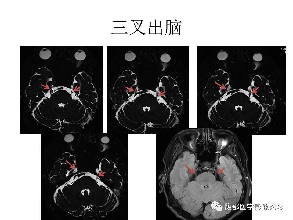 影像PPT - 【PPT】十二颅神孔道出-40