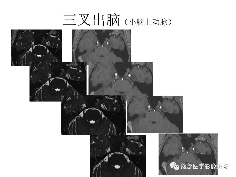 影像PPT - 【PPT】十二颅神孔道出-43