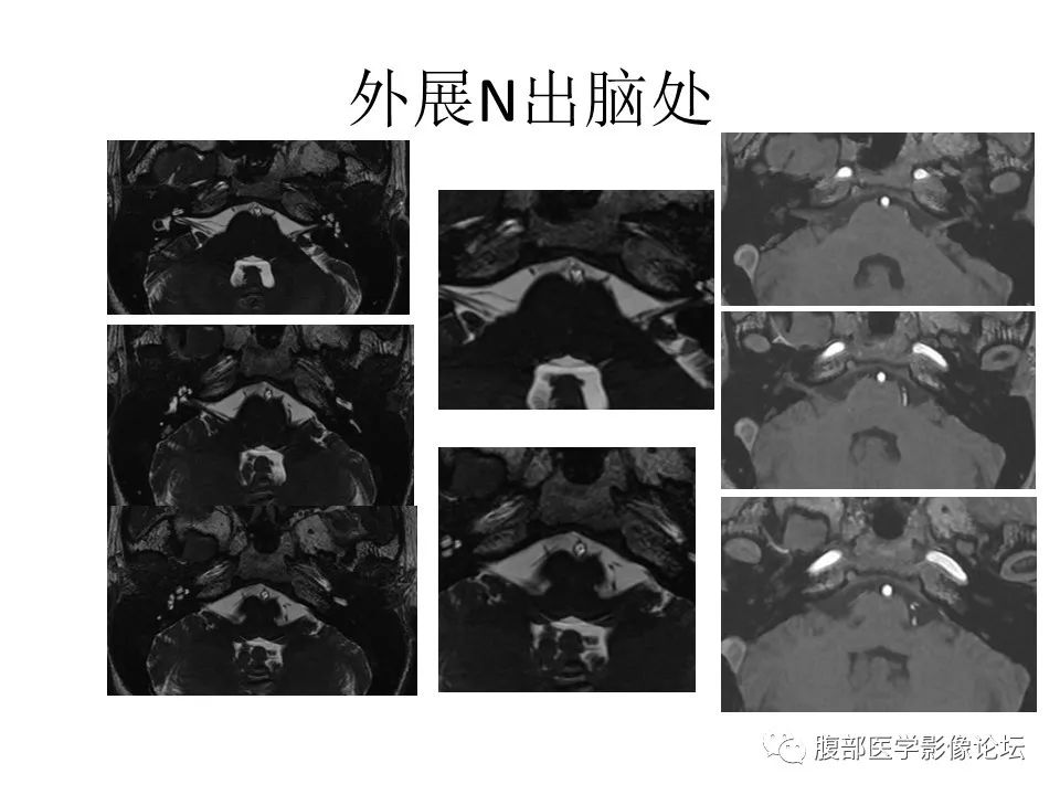 影像PPT - 【PPT】十二颅神孔道出-44