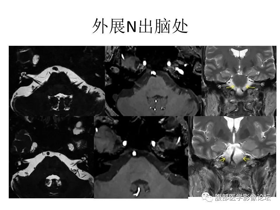 影像PPT - 【PPT】十二颅神孔道出-45