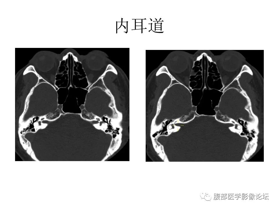 影像PPT - 【PPT】十二颅神孔道出-46