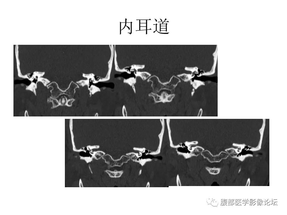 影像PPT - 【PPT】十二颅神孔道出-47