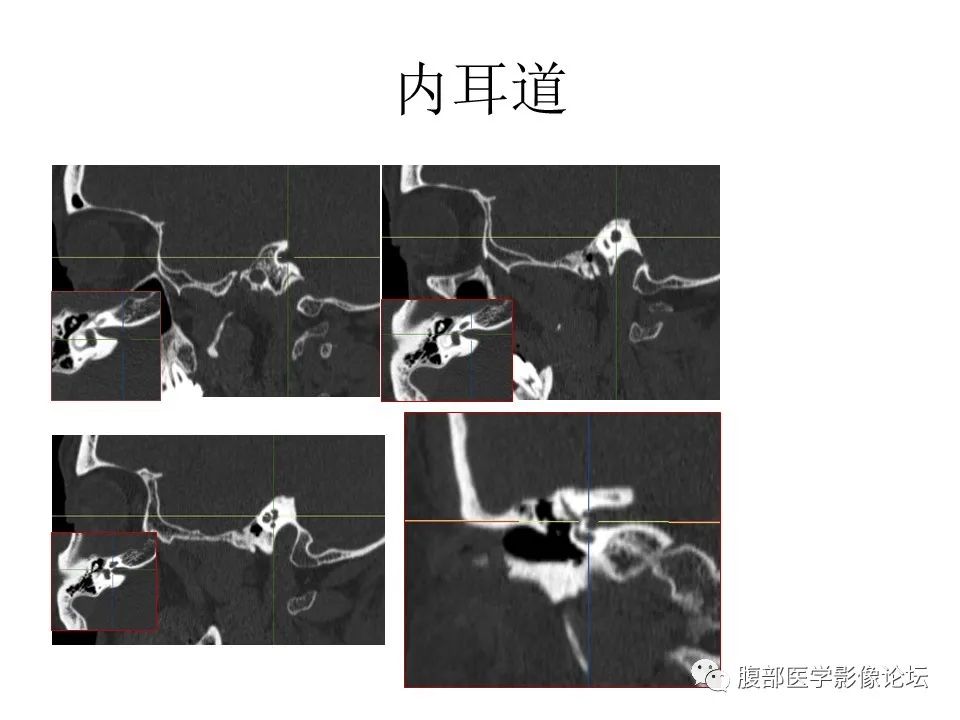 影像PPT - 【PPT】十二颅神孔道出-48