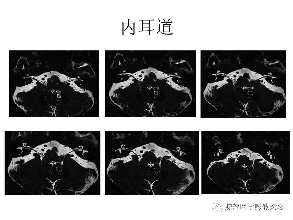 影像PPT - 【PPT】十二颅神孔道出-49