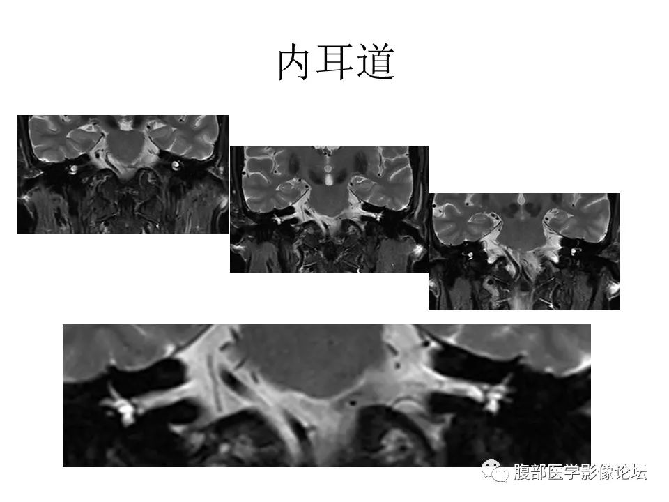 影像PPT - 【PPT】十二颅神孔道出-51