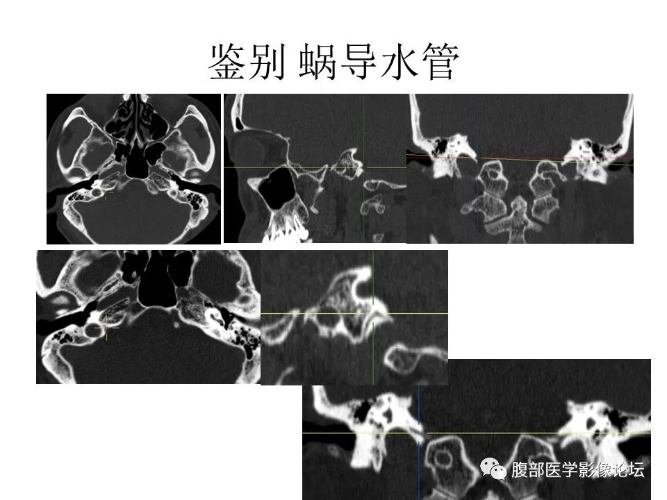 影像PPT - 【PPT】十二颅神孔道出-52