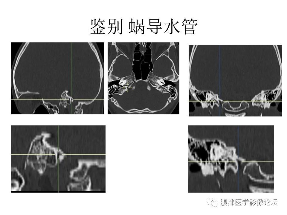 影像PPT - 【PPT】十二颅神孔道出-53