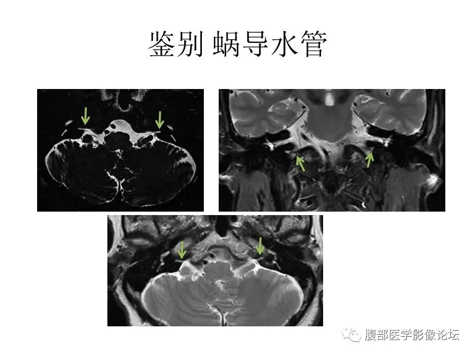 影像PPT - 【PPT】十二颅神孔道出-54