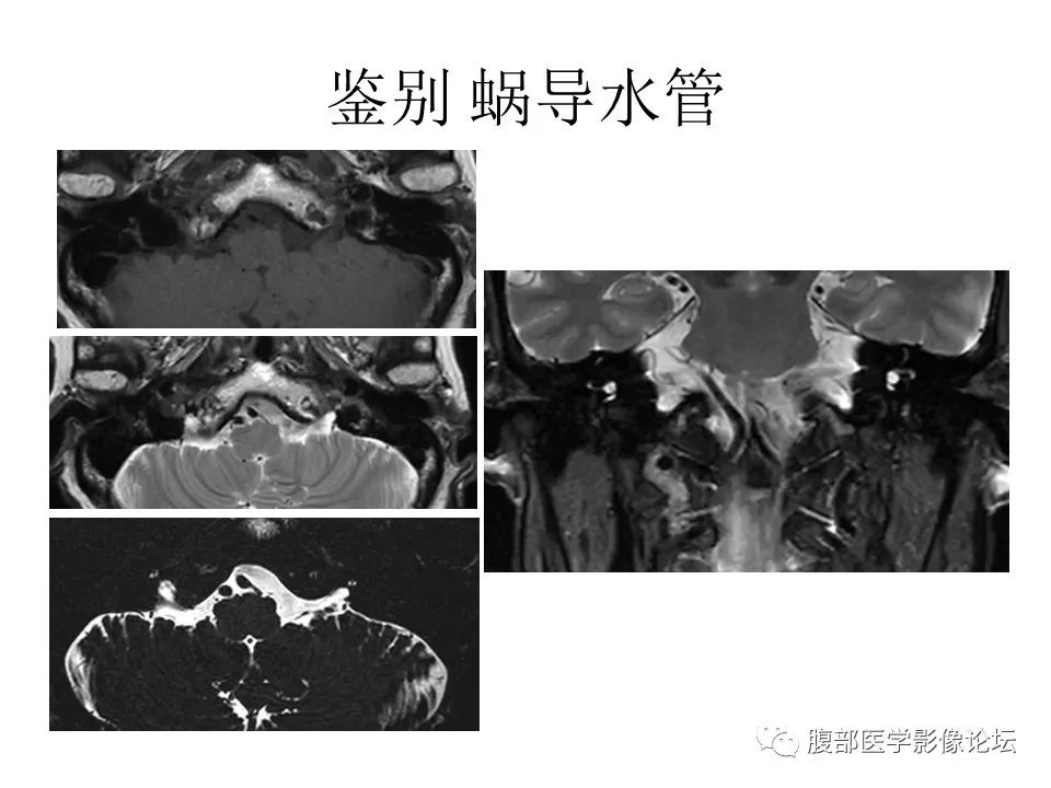 影像PPT - 【PPT】十二颅神孔道出-55