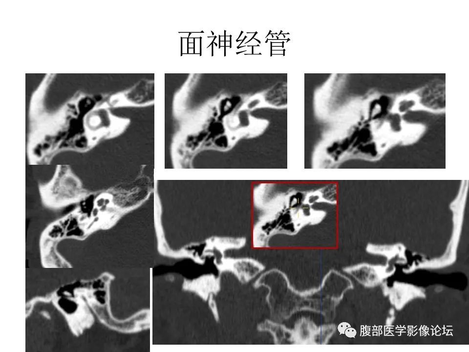 影像PPT - 【PPT】十二颅神孔道出-56
