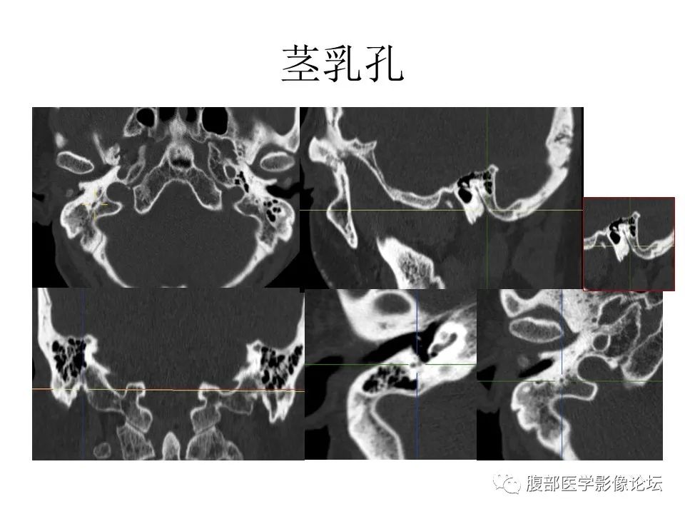 影像PPT - 【PPT】十二颅神孔道出-57