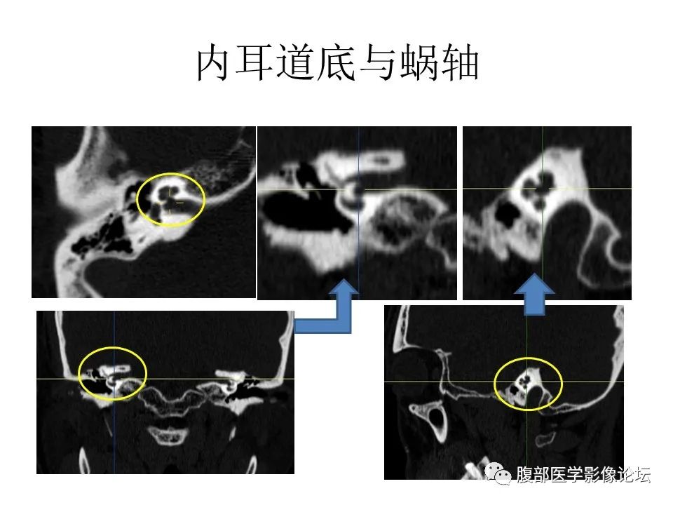 影像PPT - 【PPT】十二颅神孔道出-58