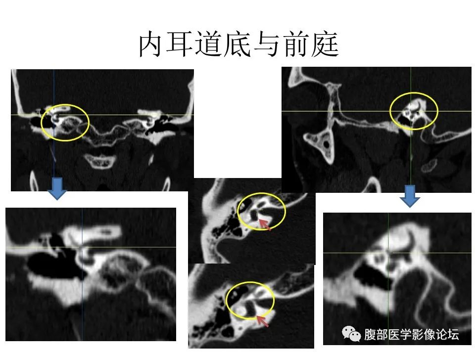 影像PPT - 【PPT】十二颅神孔道出-59