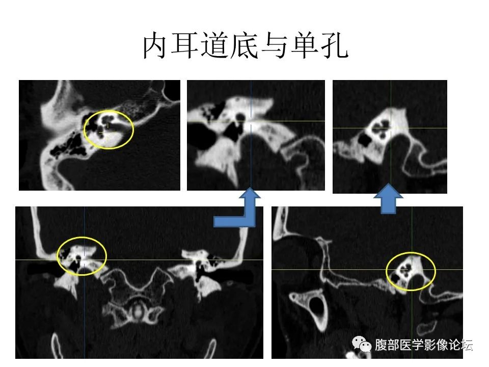 影像PPT - 【PPT】十二颅神孔道出-60