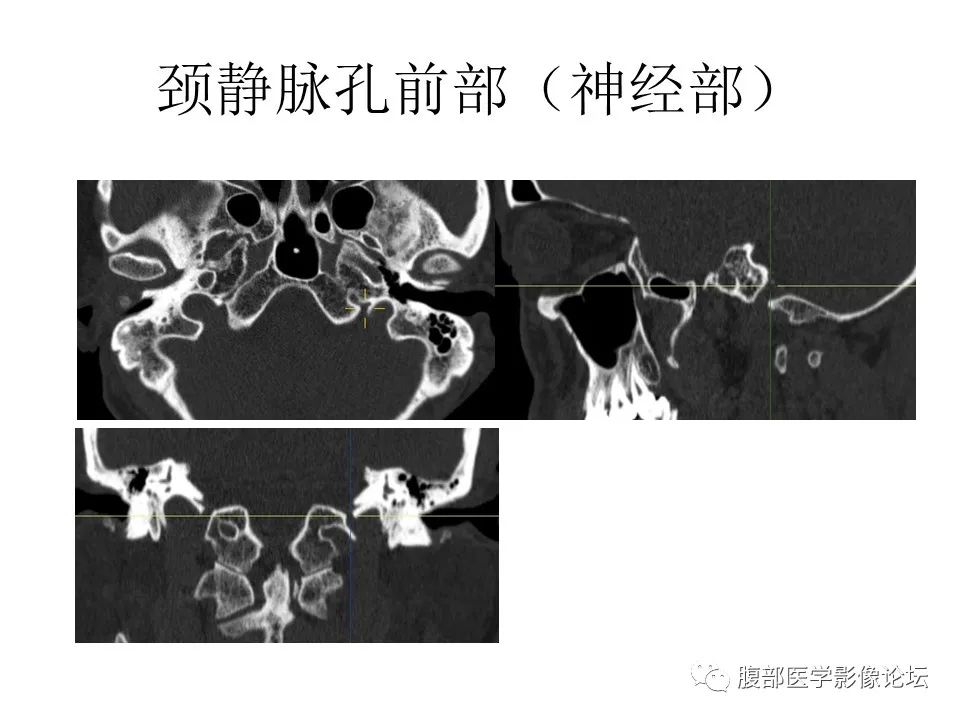 影像PPT - 【PPT】十二颅神孔道出-61