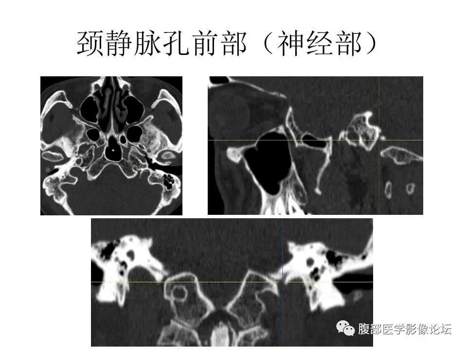 影像PPT - 【PPT】十二颅神孔道出-62