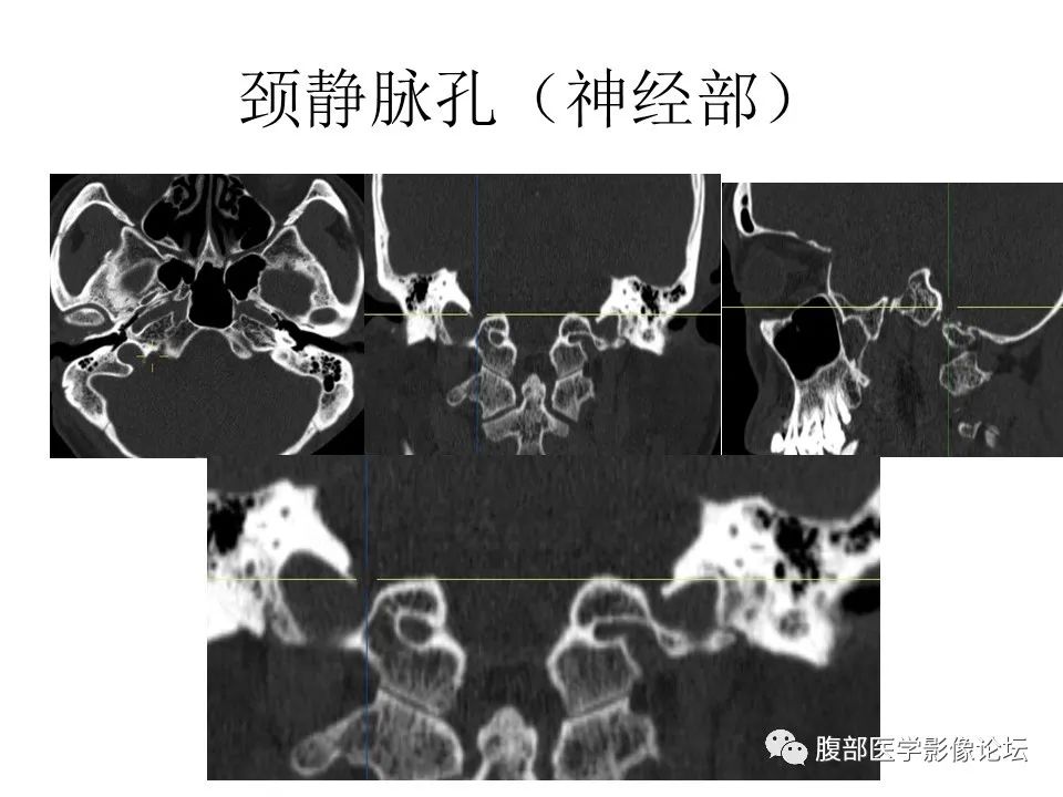 影像PPT - 【PPT】十二颅神孔道出-63
