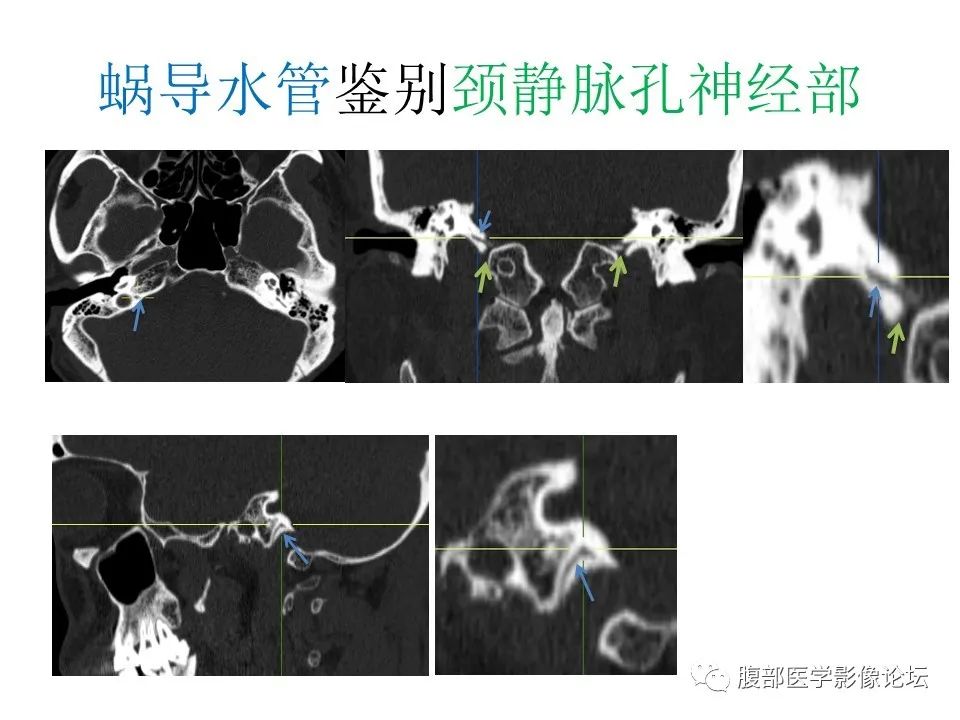 影像PPT - 【PPT】十二颅神孔道出-64