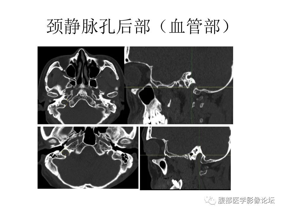 影像PPT - 【PPT】十二颅神孔道出-65