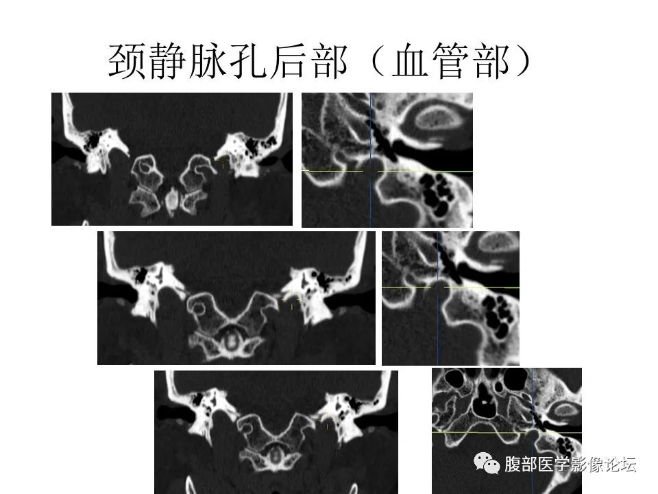 影像PPT - 【PPT】十二颅神孔道出-66