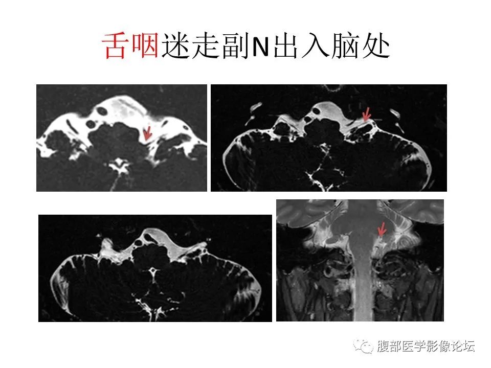 影像PPT - 【PPT】十二颅神孔道出-67