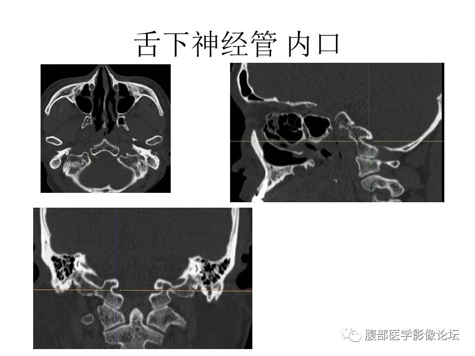 影像PPT - 【PPT】十二颅神孔道出-69